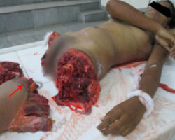 18 year old Indian girl in morgue