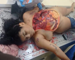 Autopsy of Venezuelan model