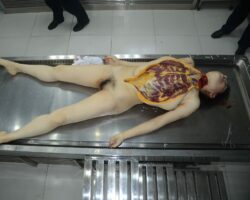 Autopsy of cute Chinese woman
