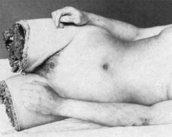 MIX: Old photos of dismembered women