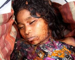 Raped and almost beheaded young girl