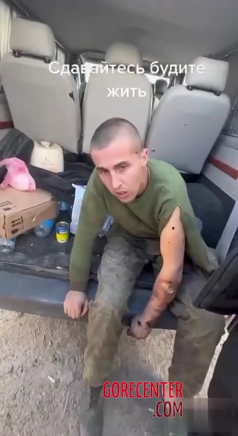 Russian soldier with an infected hand with worms • GoreCenter