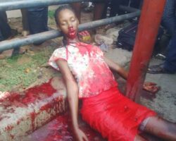 Nigerian student bled to death