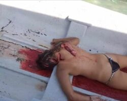 Young girl hit by a ship’s screw