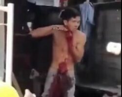 Man cut his own throat on the street