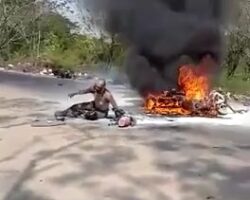 Burned man in a motorcycle accident