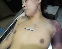 Chinese female in morgue