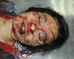 Chinese girl in morgue