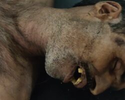 Annotated autopsy of unidentified man