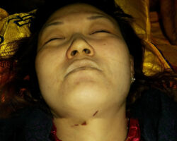 Chinese woman died from injuries all over her body
