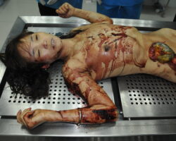 Chinese woman in morgue #6