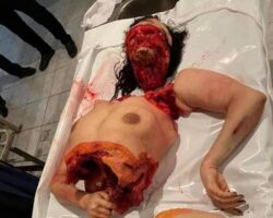 Dismembered woman with her face skinned