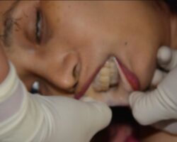 MIX: Focused on death teeth