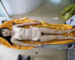 Woman's body examination in morgue