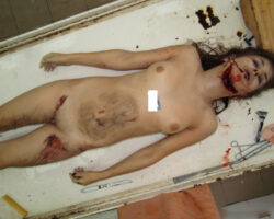 Naked woman in morgue
