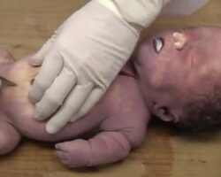 Autopsy of a newborn