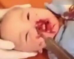 Baby stabbed in face