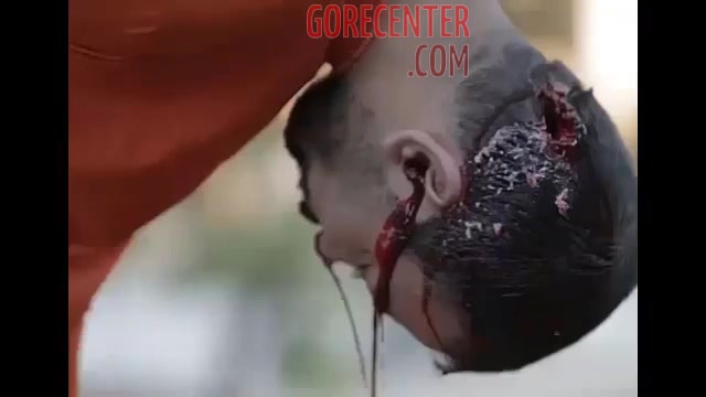 Execution by sniper rifle shot to head • GoreCenter