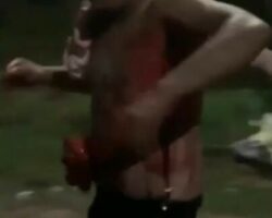 Man with organs outside after fight
