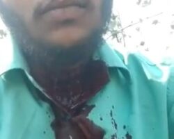Man is bleeding from his neck