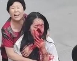 Chinese woman with ruined face