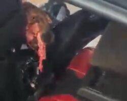 Dude with his head destroyed after car crash