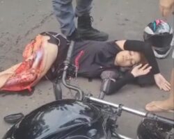 Female biker with crushed leg