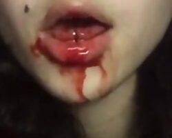 Girl cuts tongue with box cutter
