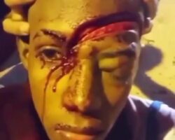 Guy sits in shock with deep gash across his face