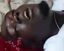 Guy still gasping for air after being shot in head