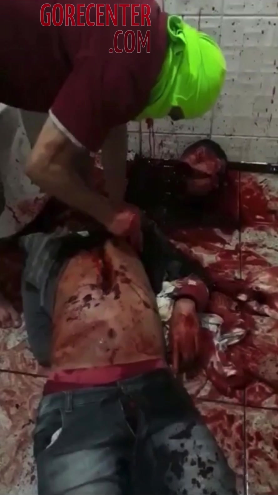 Heart removed from the body still beats • GoreCenter