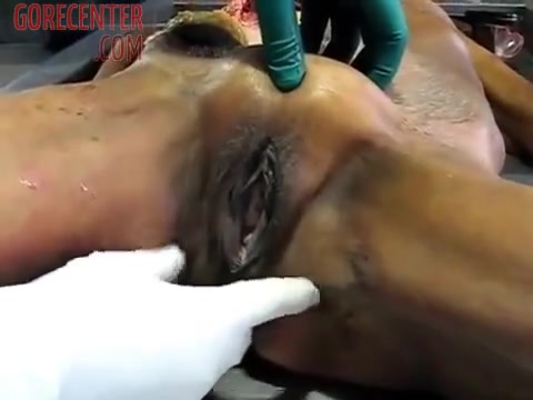 pussy girl autopsy 