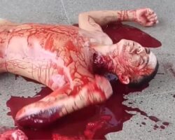 Dude loses blood with each heartbeat