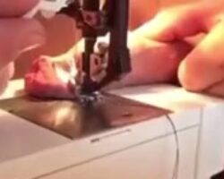 Man sewed his penis on sewing machine
