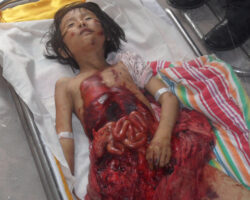 Chinese 7-year-old village girl died in car accident