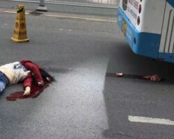 Chinese young girl lost her brain in car accident