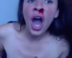 Naked girl punching herself until her nose bleeds