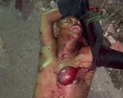 Mutilated guy dumped on the side of road