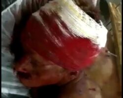 Dude was beaten with wooden plank with nails