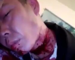 Man is bleeding after slitting his own throat