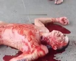 Man slowly dies as blood spews from wound in his neck