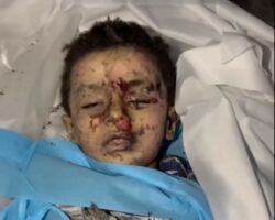 Beheaded child is taken to hospital after Israeli airstrike