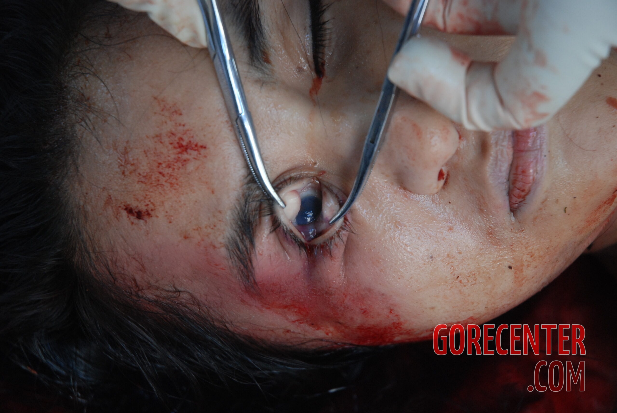 Autopsy of chinese woman with broken head * gorecenter