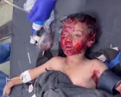 Little Palestinian boy choking on his own blood