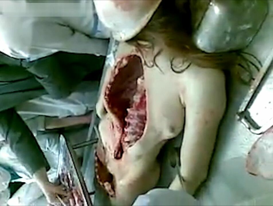 of autopsy of young Russian woman • GoreCenter