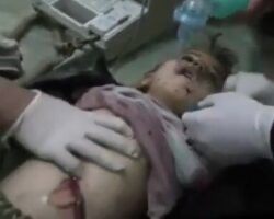 Dying little girl after traffic accident