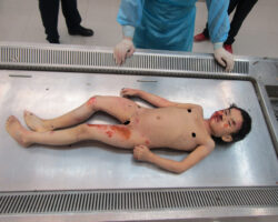 Examination of body of little Chinese girl