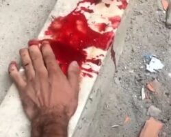 Favela thief gets his fingers chopped off with machete