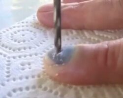 Man drills his fingernail