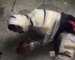 Mummy-wrapped thief is painfully beaten
